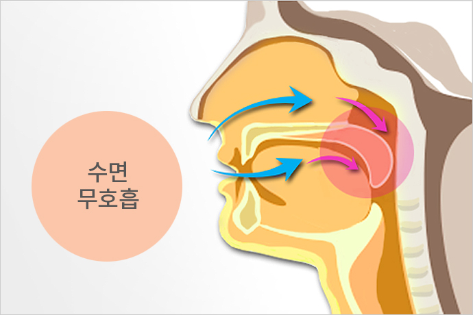 부천사과나무치과